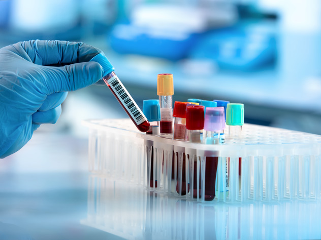 Logistics and supply chain solution for diagnostics and testing
